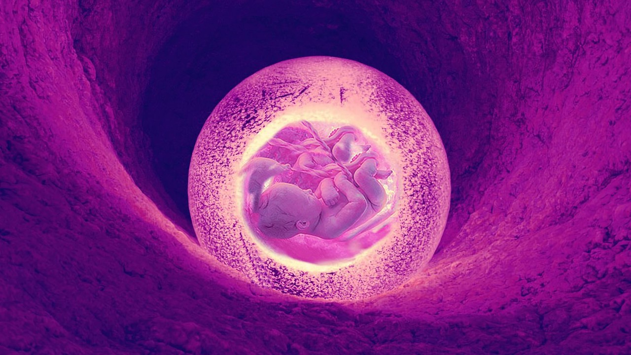 Post Image