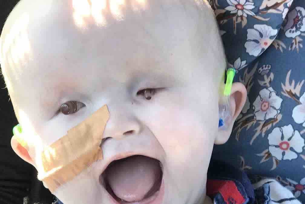 Baby Born Without Eyes: A Guide To Bilateral Anophthalmia And Its Implications Baby Born Without Eyes: A Guide To Bilateral Anophthalmia And Its Implications