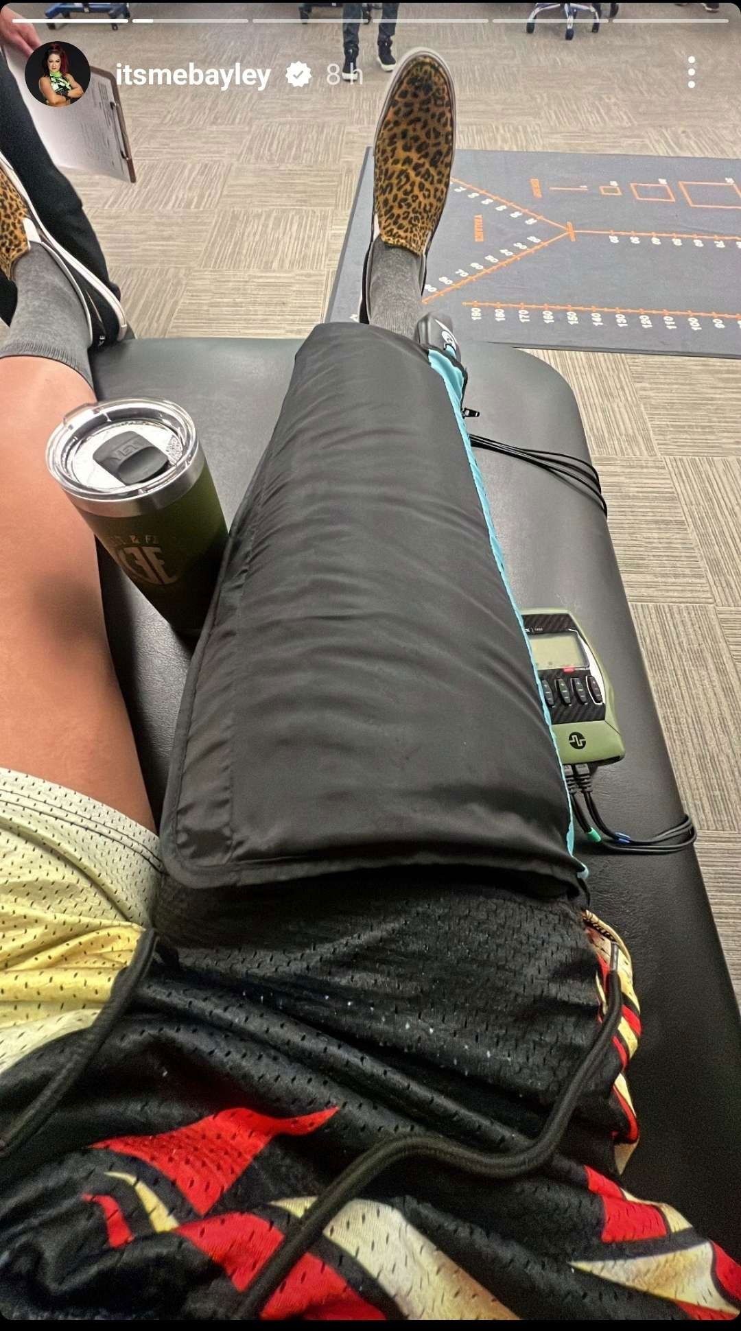 Bayley Injury News And Speculation On A Cena Vs. Orton Match Bayley Injury News And Speculation On A Cena Vs. Orton Match