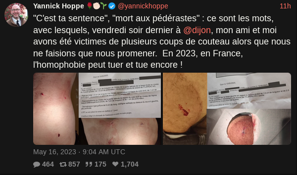 Dijon - Lac Kir: Enquête Après Une Agression Sauvage De Trois Hommes Dijon - Lac Kir: Enquête Après Une Agression Sauvage De Trois Hommes