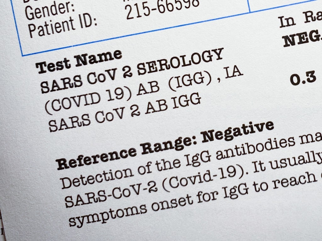 Fake COVID Test Results: Lab Owner's Guilty Plea Fake COVID Test Results: Lab Owner's Guilty Plea