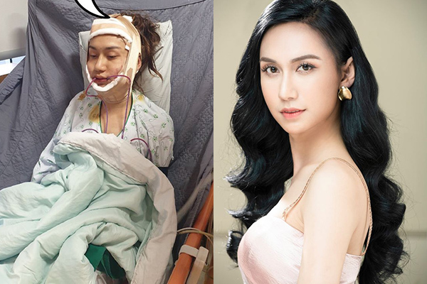 Hành Trình Chuyển Giới Của Lynk Lee: Từ Nhan Sắc Đến Tình Yêu Hành Trình Chuyển Giới Của Lynk Lee: Từ Nhan Sắc Đến Tình Yêu