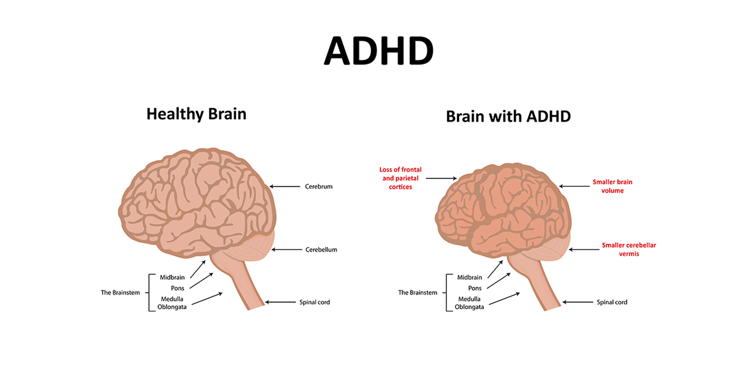 Inside Our ADHD Minds: Strategies For Success And Well-being Inside Our ADHD Minds: Strategies For Success And Well-being