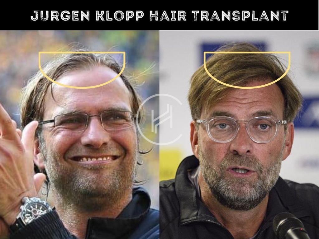 Jürgen Klopp: Anfield Return Before Liverpool's Final Game Jürgen Klopp: Anfield Return Before Liverpool's Final Game