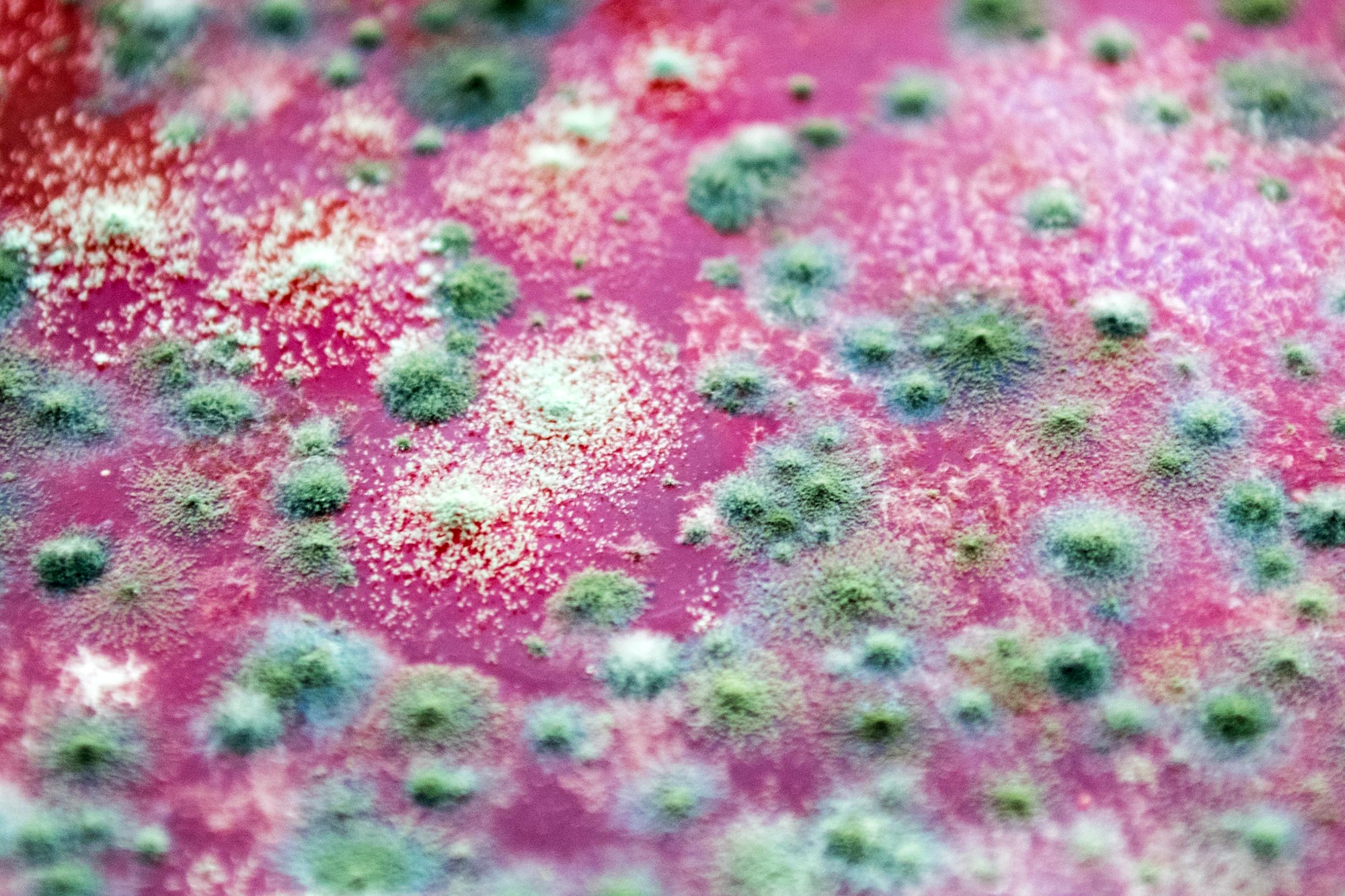 The Rise Of Deadly Fungi: A Looming Public Health Emergency The Rise Of Deadly Fungi: A Looming Public Health Emergency