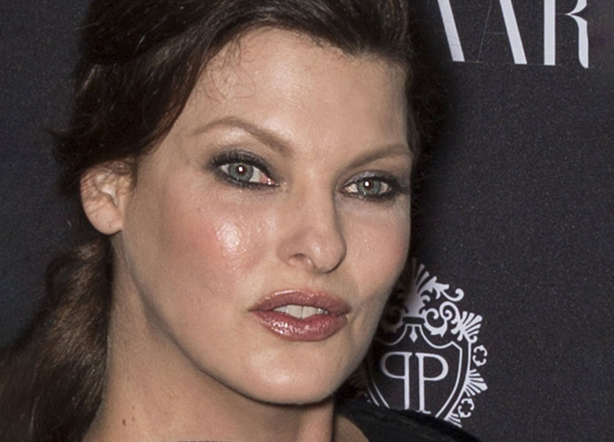 Understanding CoolSculpting Complications: Lessons From Linda Evangelista's Experience Understanding CoolSculpting Complications: Lessons From Linda Evangelista's Experience