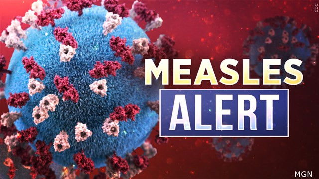 Virginia Confirms Second Measles Case For 2025: Public Health Alert Virginia Confirms Second Measles Case For 2025: Public Health Alert