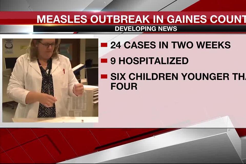 Virginia Reports Second Measles Case In 2025: Health Officials Investigate Virginia Reports Second Measles Case In 2025: Health Officials Investigate